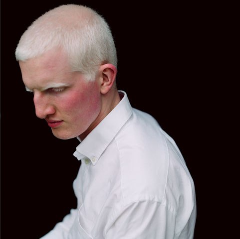 Серия фотографий под названием  Красота альбиносов” от Паолы де Грене