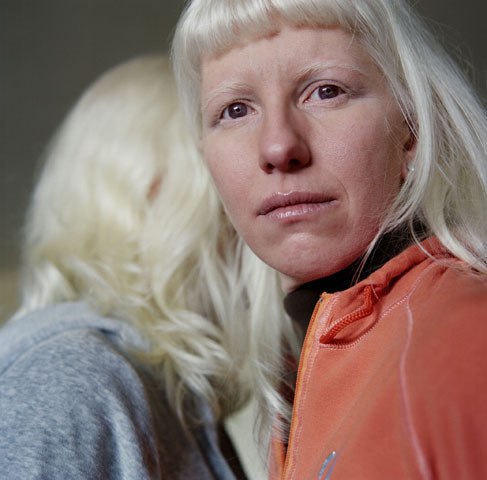 Серия фотографий под названием  Красота альбиносов” от Паолы де Грене