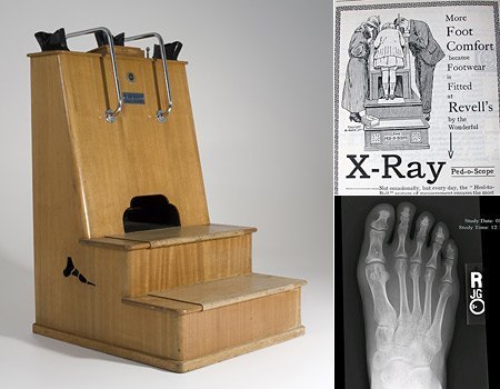 В 1927 году был запатентован флюороскоп для обувных магазинов, поступивший в американские и европейские салоны. Покупателю делали рентгеновский снимок ног, по которому было очень удобно подбирать обувь. Однако после многочисленных жалоб на ущерб здоровью от ударной дозы радиации (одной женщине даже ампутировали ноги), все аппараты были отозваны и уничтожены.