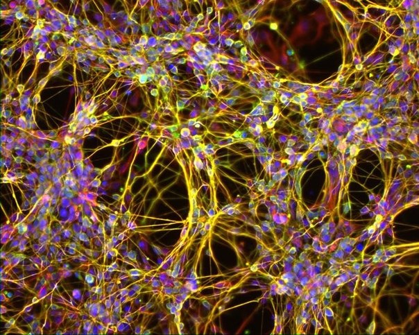 Так выглядят нейроны- нервные клетки человека