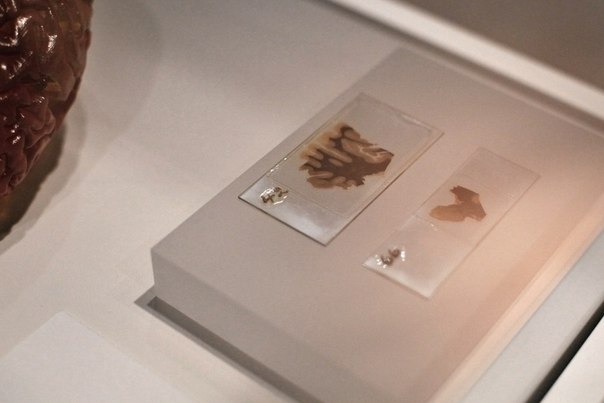 Два среза мозга Альберта Эйнштейна на выставке «Мозг — разум и материя» в музее Wellcome Collection, Лондон, Великобритания. 