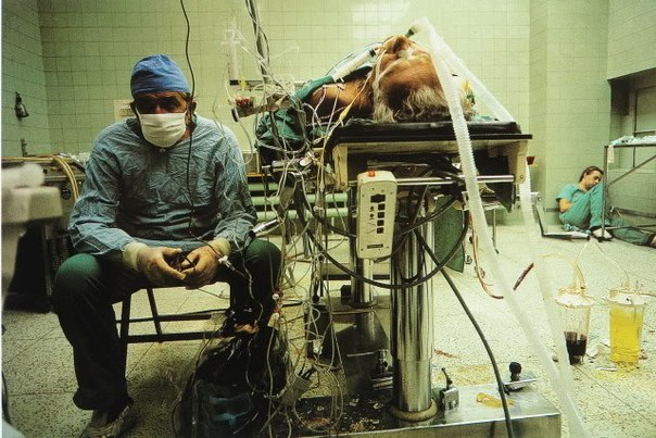 Снимок хирурга после проведенной им 23-часовой операции на сердце.